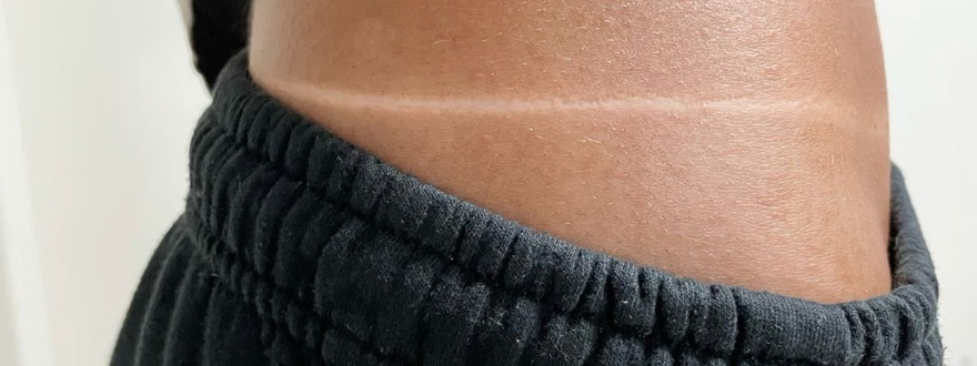 Spray Tan